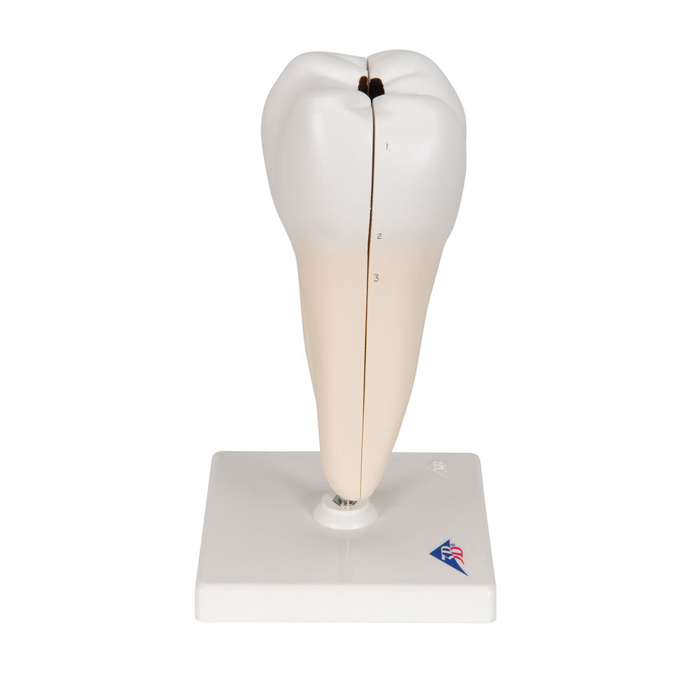 Lower Twin-Root Molar with Cavities Human Tooth Model, 2 Part