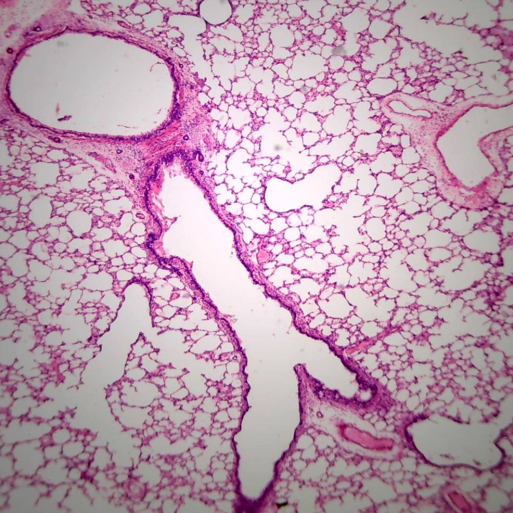 Microscope Slide – Lung Section Showing Alveoli and Bronchioles